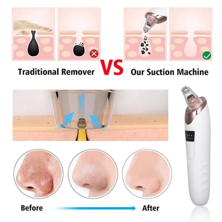 Face Vacuum Blackhead